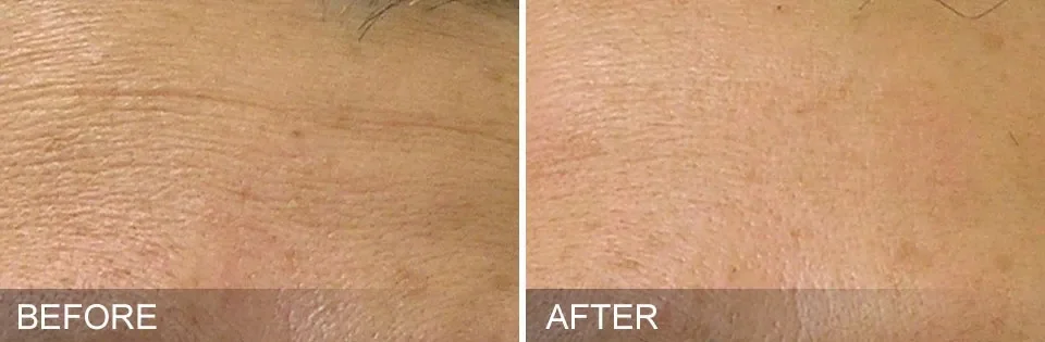 Boston, Medical, Personalized Beauty Treatments At Windham Med Spa