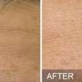 Personalized Beauty Treatments At Windham Med Spa