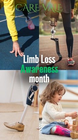 Hyderabad, Food & Drink, Best Artificial Leg  In Hyderabad | CareVale Prosthetics