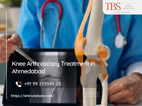 Ahmedabad, Health, Knee Arthroscopy Treatment In Ahmedabad | Advanced Knee Care