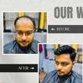 INR 8000,  Restore Your Hair At The Best Hair Patch Center Kolkata &ndash; Indian Hair World