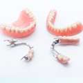 Root Canal Services In Mohali By Experts
