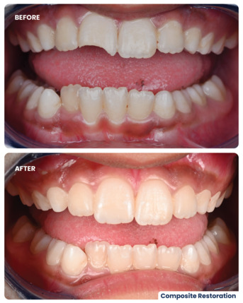 Dubai, Dental, Pediatric Dental Care In Dubai