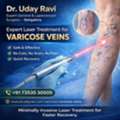 Expert Laser Treatment For Varicose Veins &ndash; Dr. Uday Ravi