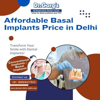New Delhi, Dental, Affordable Basal Implants Price In Delhi At Dr. Garg&rsquo;s Multispeciality Dental Center