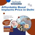 Affordable Basal Implants Price In Delhi At Dr. Garg&rsquo;s Multispeciality Dental Center