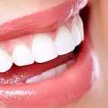 Smile Dentistry Brampton| Trusted & Affordable Care Now