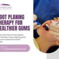 Deep Root Cleaning For Healthier Gum Support