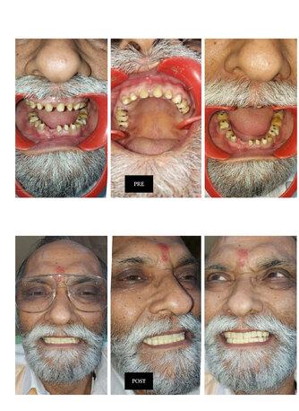 New Delhi, Health, Best Dentist In Delhi NCR