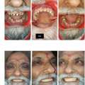 Best Dentist In Delhi NCR
