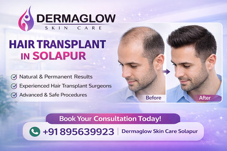 Mumbai, Medical, Painless Hair Transplant In Solapur With Natural Results