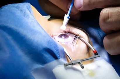Faridabad, Health, Best Eye Hospital In Faridabad | Advanced Vision Care & Surgery