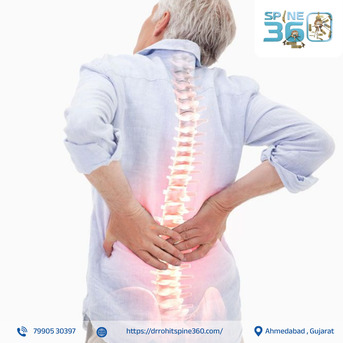 Ahmedabad, Health, Get Expert Spine Consultation In Ahmedabad By Dr. Rohit Thaker At Spine362