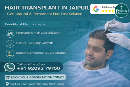Jaipur, Health & Beauty Items, INR 29999,  Hair Transplant In Jaipur - Get Permanent Hair Loss Solutions
