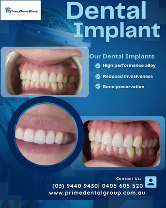 Melbourne, Dental, Dentist Thornbury, Northcote, Dental Clinic Thornbury