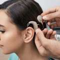 Cochlear Implants For Adults: Advanced Hearing Solutions