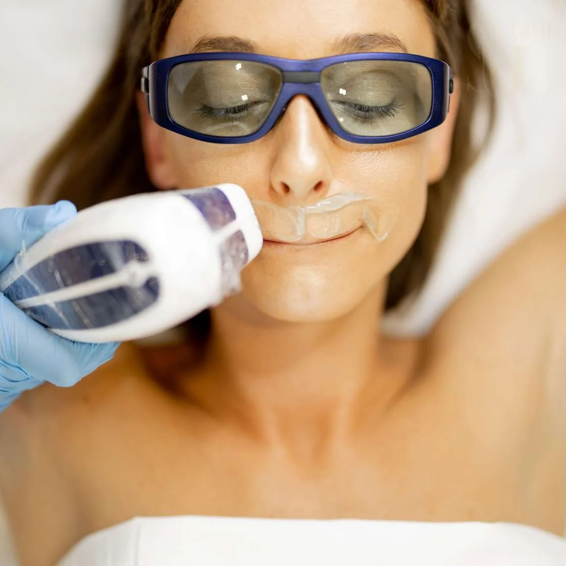 New Delhi, Health, Get Smooth, Hair-Free Skin With Expert Laser Hair Removal Treatment In Lajpat Nagar