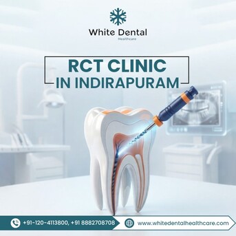 Mumbai, Dental, Looking For A Reliable RCT Clinic In Indirapuram?