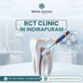 Looking For A Reliable RCT Clinic In Indirapuram?