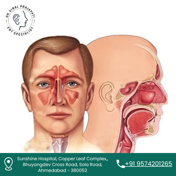 Ahmedabad, Health, Consult The Best ENT Surgeon In Ahmedabad For Expert Care