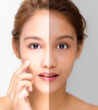 Singapore, Health, Lightening Skin Treatment For Radiant And Even-Toned Skin