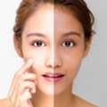 Lightening Skin Treatment For Radiant And Even-Toned Skin