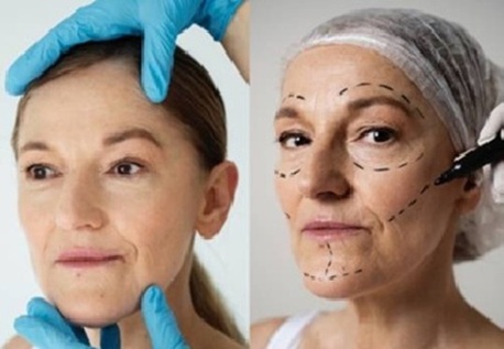 Sydney, Medical, Find Affordable Face Lift Cost In Adelaide For Effective Surgery