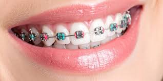 New Delhi, Dental, Braces Near Me