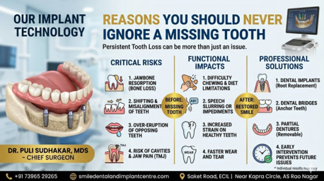 Hyderabad, Dental, MISSING A TOOTH? DONT IGNORE THE HIDDEN RISKS!