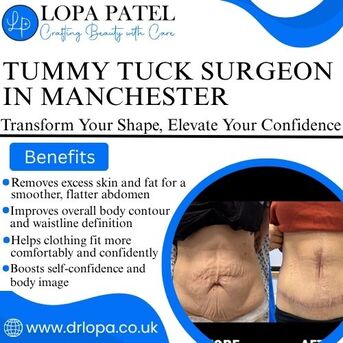 Manchester, Health, Best Tummy Tuck Surgeon In Manchester