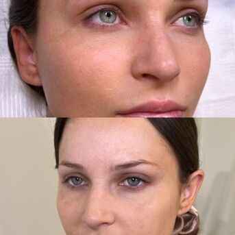 New York, Business, Miriam N Brows | Permanent Make-up Clinic | Eyebrow Bar Studio City CA