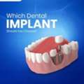 Best Dental Implants In Delhi For A Confident Smile