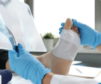 Hyderabad, Health, Diabetic Foot Ulcer Treatment In Hyderabad | Save Your Feet