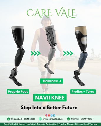 Hyderabad, Health, Best Artificial Leg  In Hyderabad | CareVale Prosthetics
