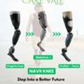 Best Artificial Leg  In Hyderabad | CareVale Prosthetics