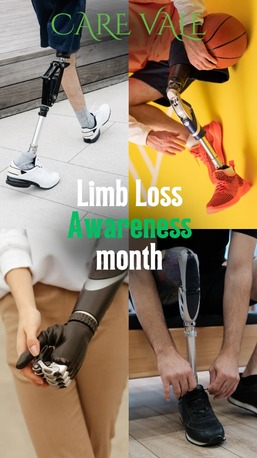 Hyderabad, Health, Best Artificial Leg  In Hyderabad | CareVale Prosthetics