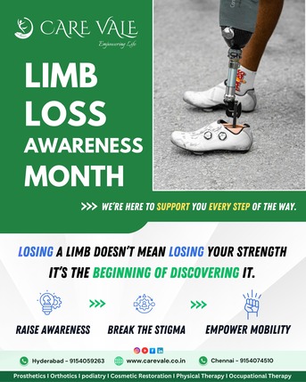 Hyderabad, Health, Best Artificial Leg  In Hyderabad | CareVale Prosthetics