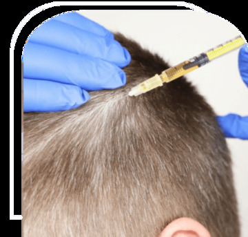 Mumbai, Medical, Best Hair Transplant Clinic In Mumbai &ndash; Vplant