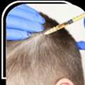 Best Hair Transplant Clinic In Mumbai &ndash; Vplant