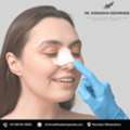 Rhinoplasty In Mumbai For A Natural Looking Nose Shape