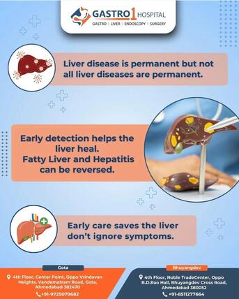 Ahmedabad, Health, Expert Liver Care In Ahmedabad With Dr. Ruchir Patel