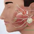 Head & Neck Cancer Surgeon In Raja Park Jaipur