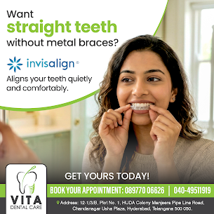 Hyderabad, Dental, Invisalign Treatment In Chandanagar  | Vita Dental Care