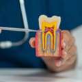 Advanced Root Canal Treatment In Al Ain