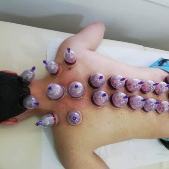 Riyadh, Health & Beauty Items, Hijama Cupping Therapy Riyadh Home Service