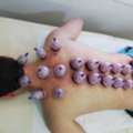Hijama Cupping Therapy Riyadh Home Service
