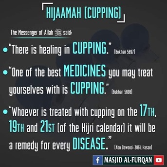 Riyadh, Health & Beauty Items, Hijama Cupping Therapy Riyadh Home Service
