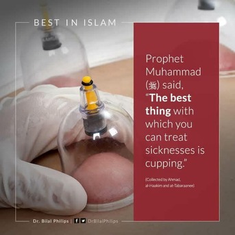 Riyadh, Health & Beauty Items, Hijama Cupping Therapy Riyadh Home Service