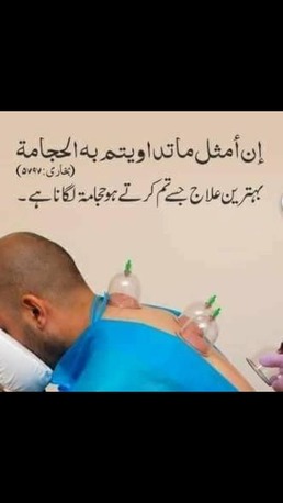 Riyadh, Health & Beauty Items, Hijama Cupping Therapy Riyadh Home Service
