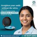 Invisible Aligners In Nanakramguda | Medics Dental